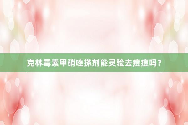 克林霉素甲硝唑搽剂能灵验去痘痘吗?